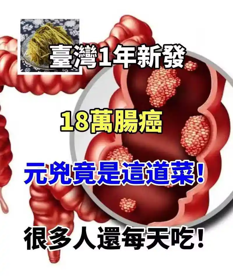 /www/bananadaily.net/web/images/image/2275/22751147.avif
